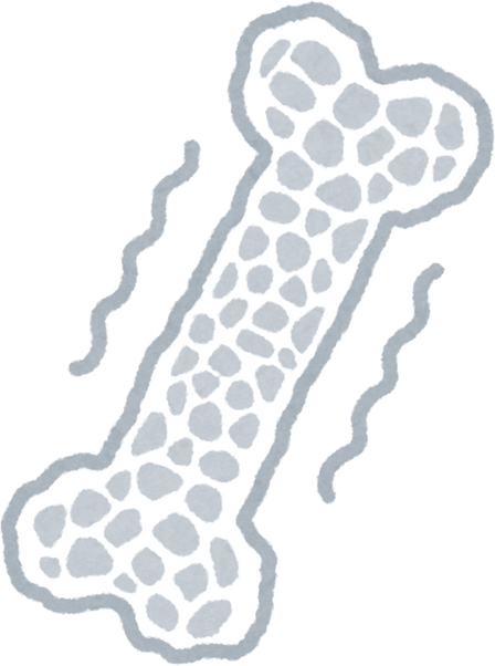 Cross-Section Illustration of a Bone with Osteoporosis